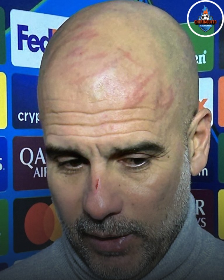 Guardiola sported scratches all over his head in a clear show of his frustration